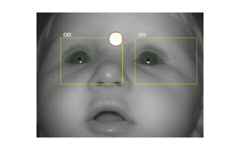 recording the baby eye movements