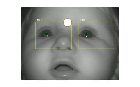 Metrovision Baby Vision Test